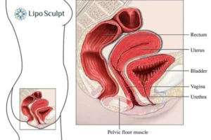 Treatment For A Leaky Bladder 2 How EM Chair treatment Ogden can help Leaky bladder issues. Read more now!